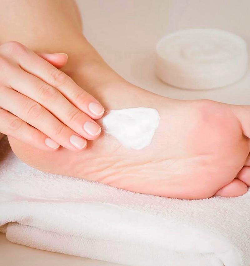Mujer echándose crema en sus talones agrietados