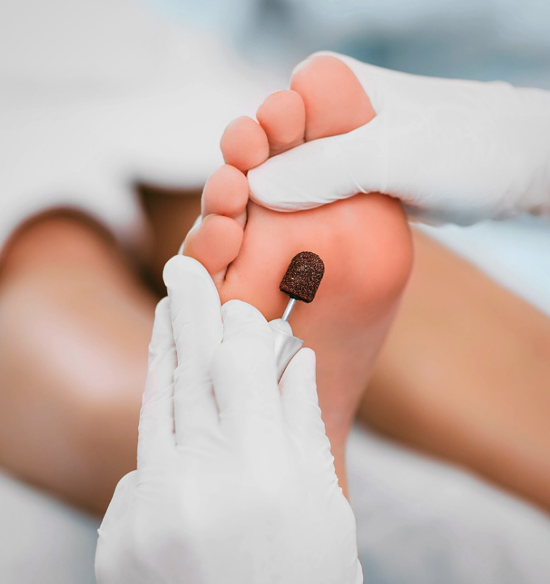 enfermedades de los pies